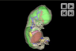 Organ Reconstructions